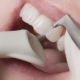 Tannstein og misfarging: Rens tennene med AirFlow