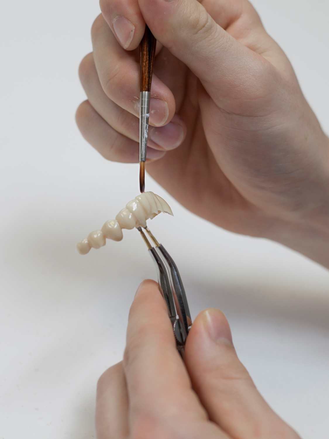 Keramisk tannbro fremstilt av tannlegen på egen lab