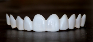 Snap on smile